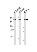 ACSF2 Antibody in Western Blot (WB)