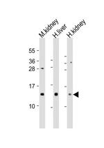 MTCP1 Antibody in Western Blot (WB)