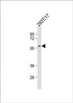 PTDSS1 Antibody in Western Blot (WB)