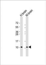 GNG2 Antibody in Western Blot (WB)