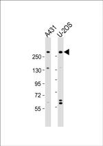 NBAS Antibody in Western Blot (WB)