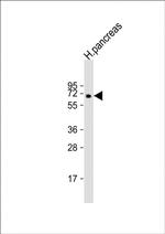 MGAT4B Antibody in Western Blot (WB)