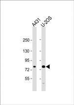 MAN1A2 Antibody in Western Blot (WB)