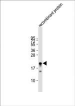 KMT2D Antibody in Western Blot (WB)