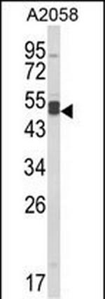 AGPAT3 Antibody in Western Blot (WB)