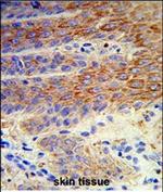 ATP12A Antibody in Immunohistochemistry (Paraffin) (IHC (P))