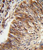 ALDH3B1 Antibody in Immunohistochemistry (Paraffin) (IHC (P))