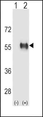 ALDH3B1 Antibody in Western Blot (WB)