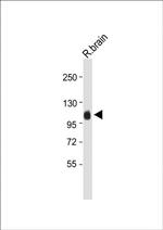 MAG Antibody in Western Blot (WB)