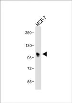 INPP4B Antibody in Western Blot (WB)