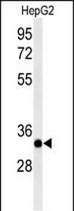 ACER3 Antibody in Western Blot (WB)