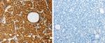 AKR1A1 Antibody in Immunohistochemistry (Paraffin) (IHC (P))