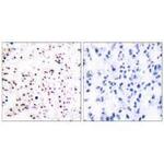 MCM5 Antibody in Immunohistochemistry (Paraffin) (IHC (P))