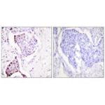 UBA52 Antibody in Immunohistochemistry (Paraffin) (IHC (P))