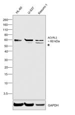 ACVRL1 Antibody in Western Blot (WB)