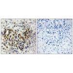 IRX3 Antibody in Immunohistochemistry (Paraffin) (IHC (P))