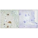 Lass4 Antibody in Immunohistochemistry (Paraffin) (IHC (P))