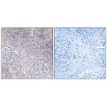 MRPL11 Antibody in Immunohistochemistry (Paraffin) (IHC (P))