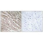 MRPL44 Antibody in Immunohistochemistry (Paraffin) (IHC (P))