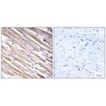 RPL3L Antibody in Immunohistochemistry (Paraffin) (IHC (P))