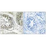 CHST13 Antibody in Immunohistochemistry (Paraffin) (IHC (P))