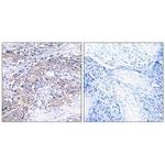 CLN6 Antibody in Immunohistochemistry (Paraffin) (IHC (P))