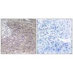 CHPF Antibody in Immunohistochemistry (Paraffin) (IHC (P))