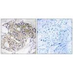 DHRS4 Antibody in Immunohistochemistry (Paraffin) (IHC (P))