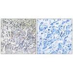 SESN1 Antibody in Immunohistochemistry (Paraffin) (IHC (P))