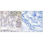 UBTD1 Antibody in Immunohistochemistry (Paraffin) (IHC (P))