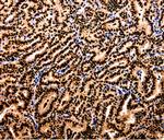 APIP Antibody in Immunohistochemistry (Paraffin) (IHC (P))