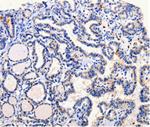 ARL6 Antibody in Immunohistochemistry (Paraffin) (IHC (P))