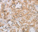 RAD54L2 Antibody in Immunohistochemistry (Paraffin) (IHC (P))