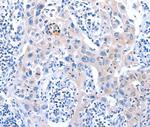 ACAD11 Antibody in Immunohistochemistry (Paraffin) (IHC (P))