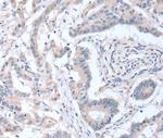 ACOT9 Antibody in Immunohistochemistry (Paraffin) (IHC (P))