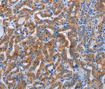 ALG12 Antibody in Immunohistochemistry (Paraffin) (IHC (P))