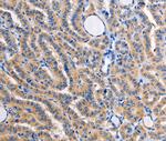 ALG8 Antibody in Immunohistochemistry (Paraffin) (IHC (P))