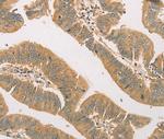 SNAP91 Antibody in Immunohistochemistry (Paraffin) (IHC (P))