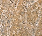 SNAP91 Antibody in Immunohistochemistry (Paraffin) (IHC (P))