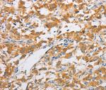 FARSB Antibody in Immunohistochemistry (Paraffin) (IHC (P))