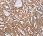 MTMR7 Antibody in Immunohistochemistry (Paraffin) (IHC (P))