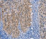 UCK1 Antibody in Immunohistochemistry (Paraffin) (IHC (P))