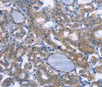 UCK1 Antibody in Immunohistochemistry (Paraffin) (IHC (P))