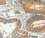 BAAT Antibody in Immunohistochemistry (Paraffin) (IHC (P))