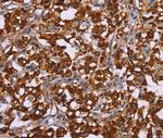 CYP2W1 Antibody in Immunohistochemistry (Paraffin) (IHC (P))