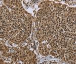 PPAT Antibody in Immunohistochemistry (Paraffin) (IHC (P))