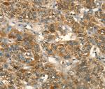 HSD17B8 Antibody in Immunohistochemistry (Paraffin) (IHC (P))