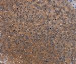 HYAL2 Antibody in Immunohistochemistry (Paraffin) (IHC (P))