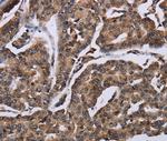 KIF1C Antibody in Immunohistochemistry (Paraffin) (IHC (P))