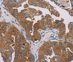 MBNL3 Antibody in Immunohistochemistry (Paraffin) (IHC (P))